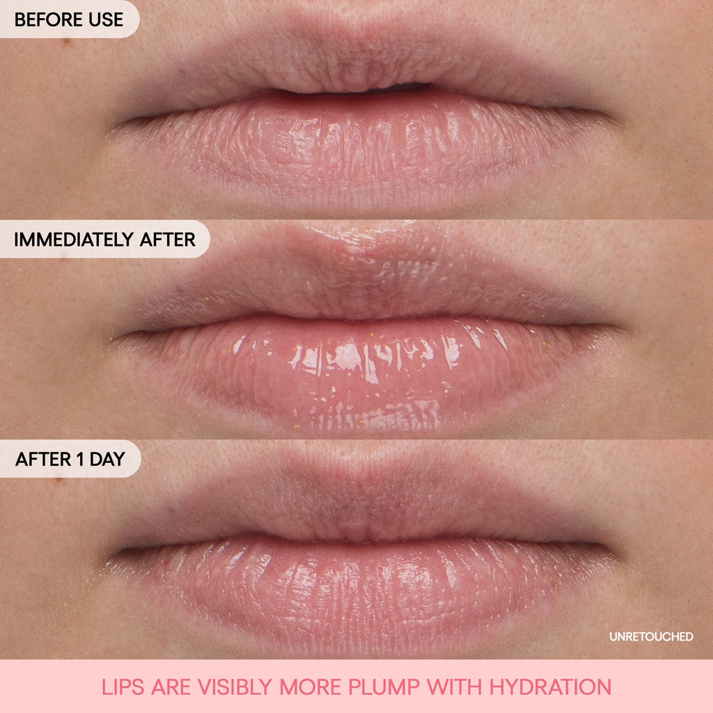 Bouncy & Firm Lip Treatment Your Next Skincare Choice