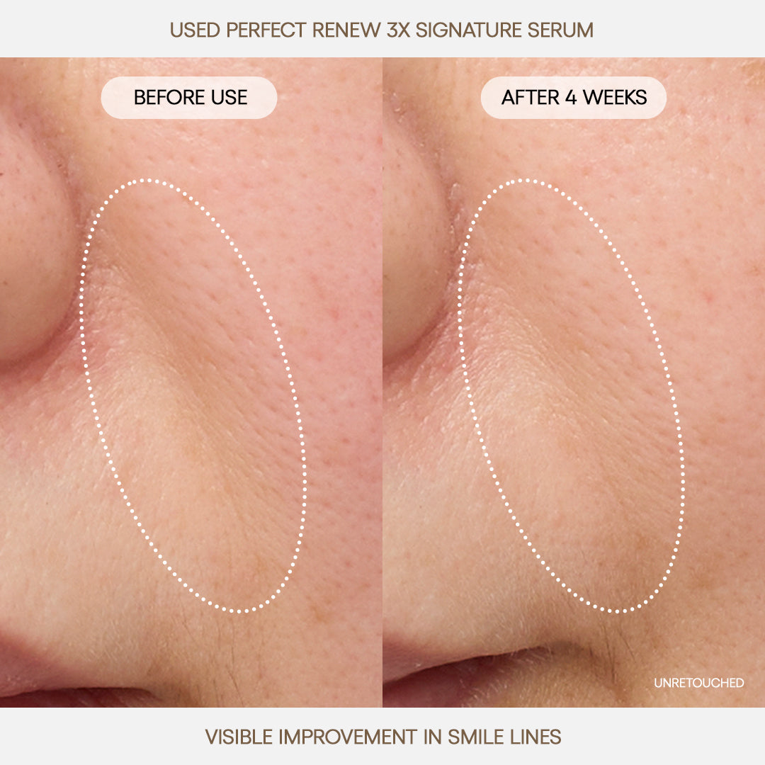 Perfect Renew 3X Signature Serum Your Personal Beauty Edit