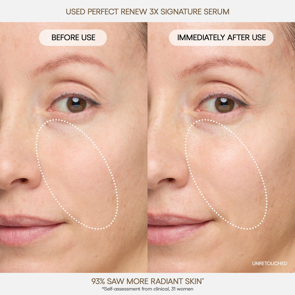 Perfect Renew 3X Signature Serum Your Personal Beauty Edit