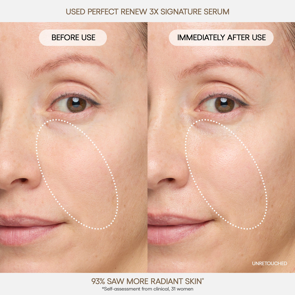 Perfect Renew 3X Signature Serum Your Personal Beauty Edit