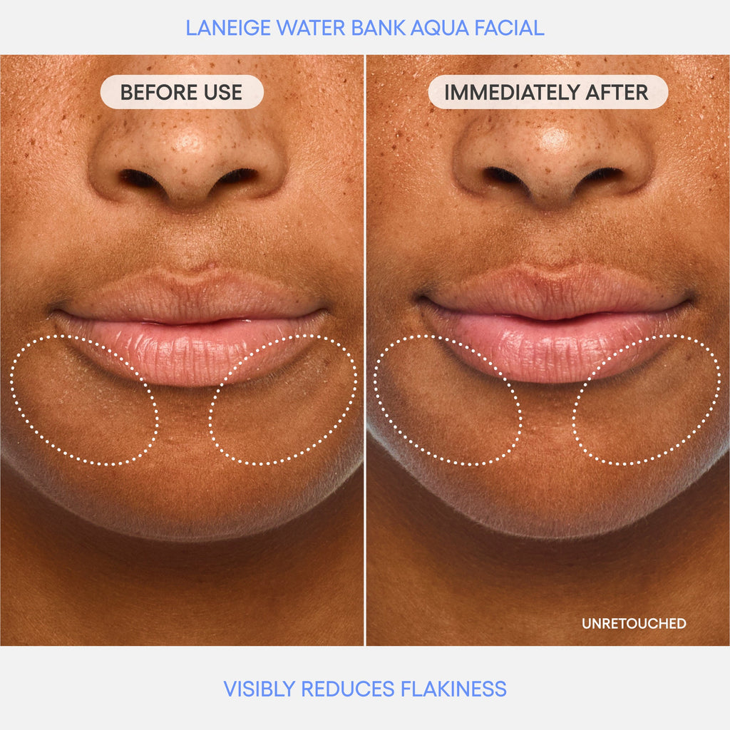 Water Bank Aqua Facial Before & After